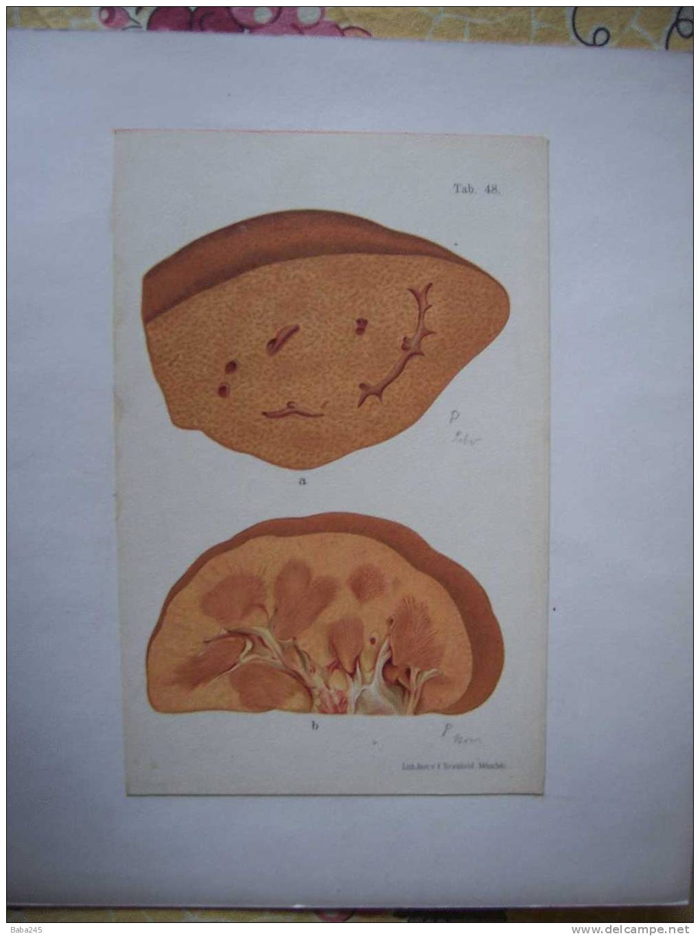 PLANCHES D'ANATOMIE MEDECINE LEGALE - Other Plans