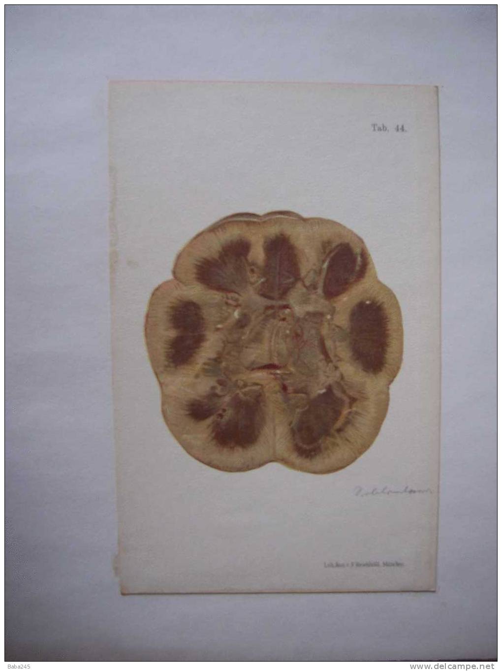 PLANCHES D'ANATOMIE MEDECINE LEGALE - Other Plans