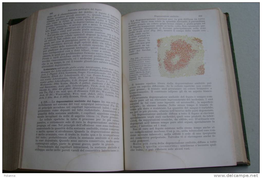 PEX/10 V.1-2 Ziegler TRATTATO ANATOMIA PATOLOGICA GENERALE E PATOLOGICA 1890/MEDICINA - Medecine, Biology, Chemistry