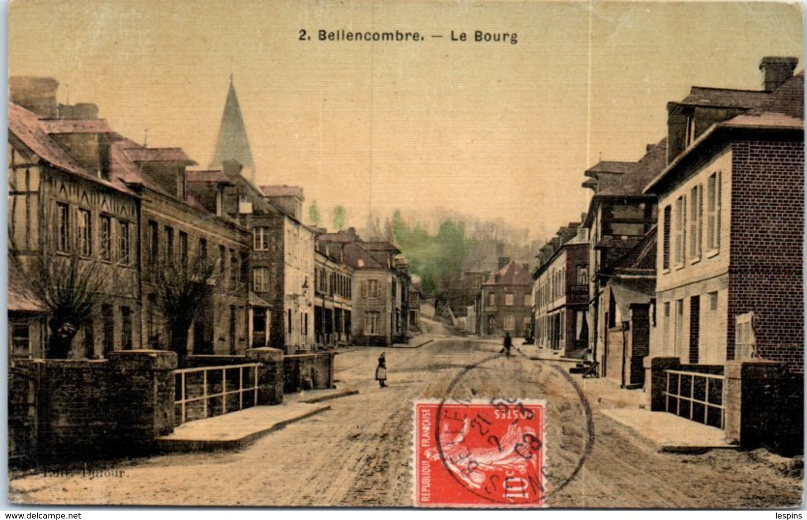 76 - BELLENCOMBRE --  Route De St Martin - Bellencombre