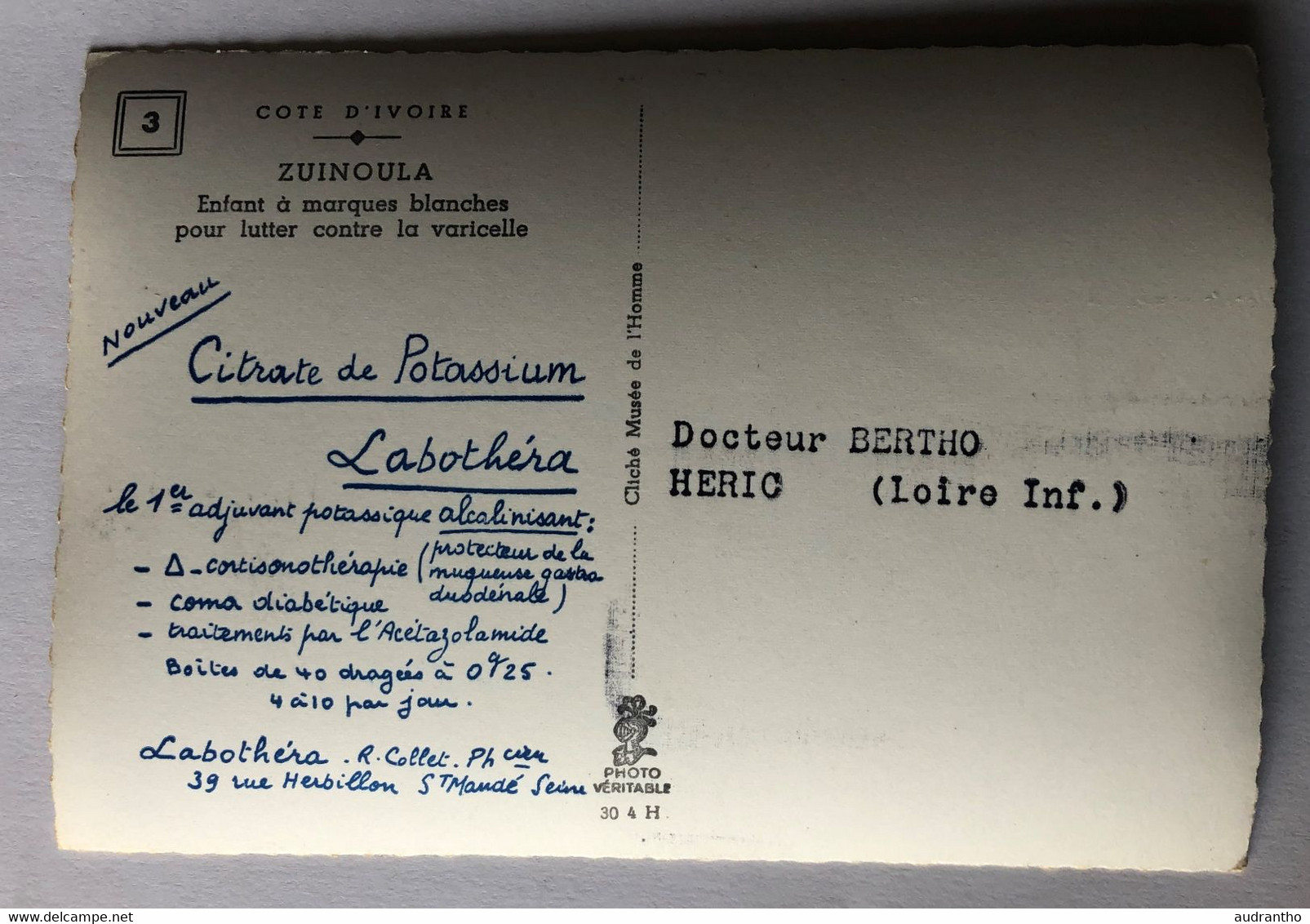 CPSM Côte D'Ivoire Zuinoula Enfant à Marques Blanches Pour Lutter Varicelle Labothéra Saint Mandé Docteur Heric Bertho - Côte-d'Ivoire