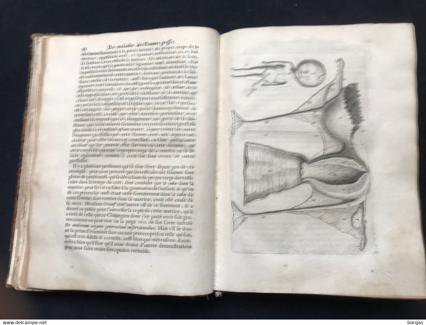 1675 - Médecine - Traité Des Maladies Des Femmes Grosses - Accouchement Gynécologie - Before 18th Century