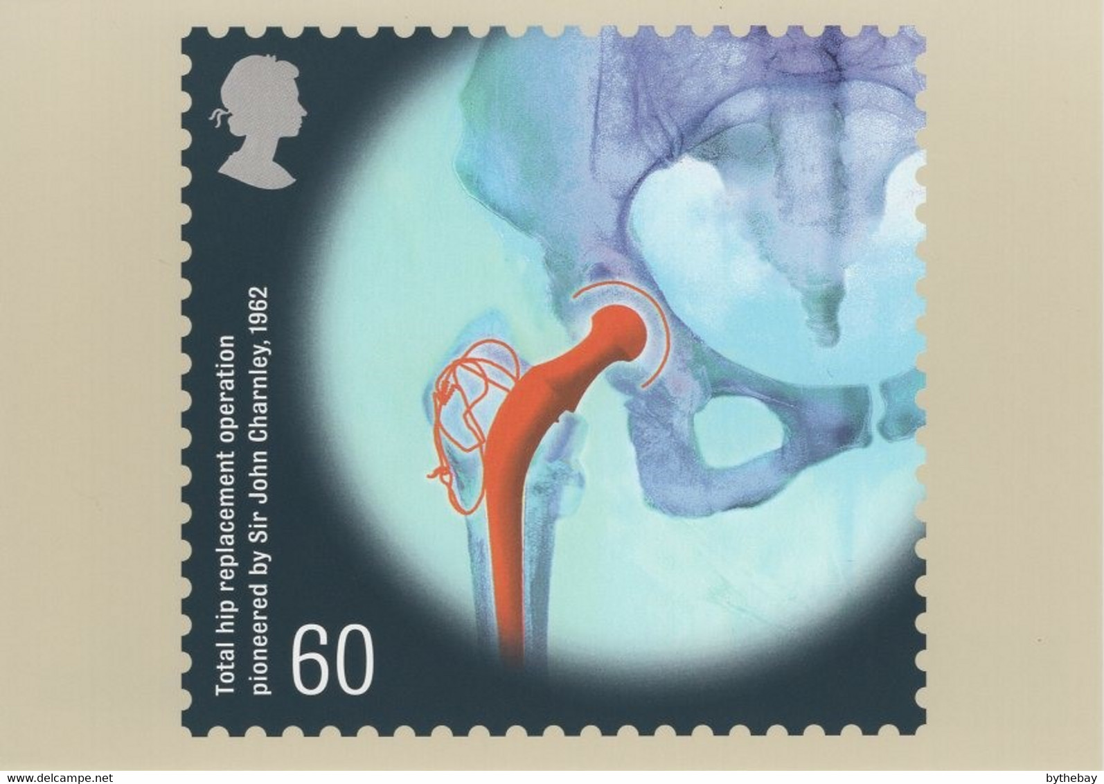 Great Britain 2010 PHQ Card Sc 2836 60p Total Hip Replacement Operation - PHQ-Cards