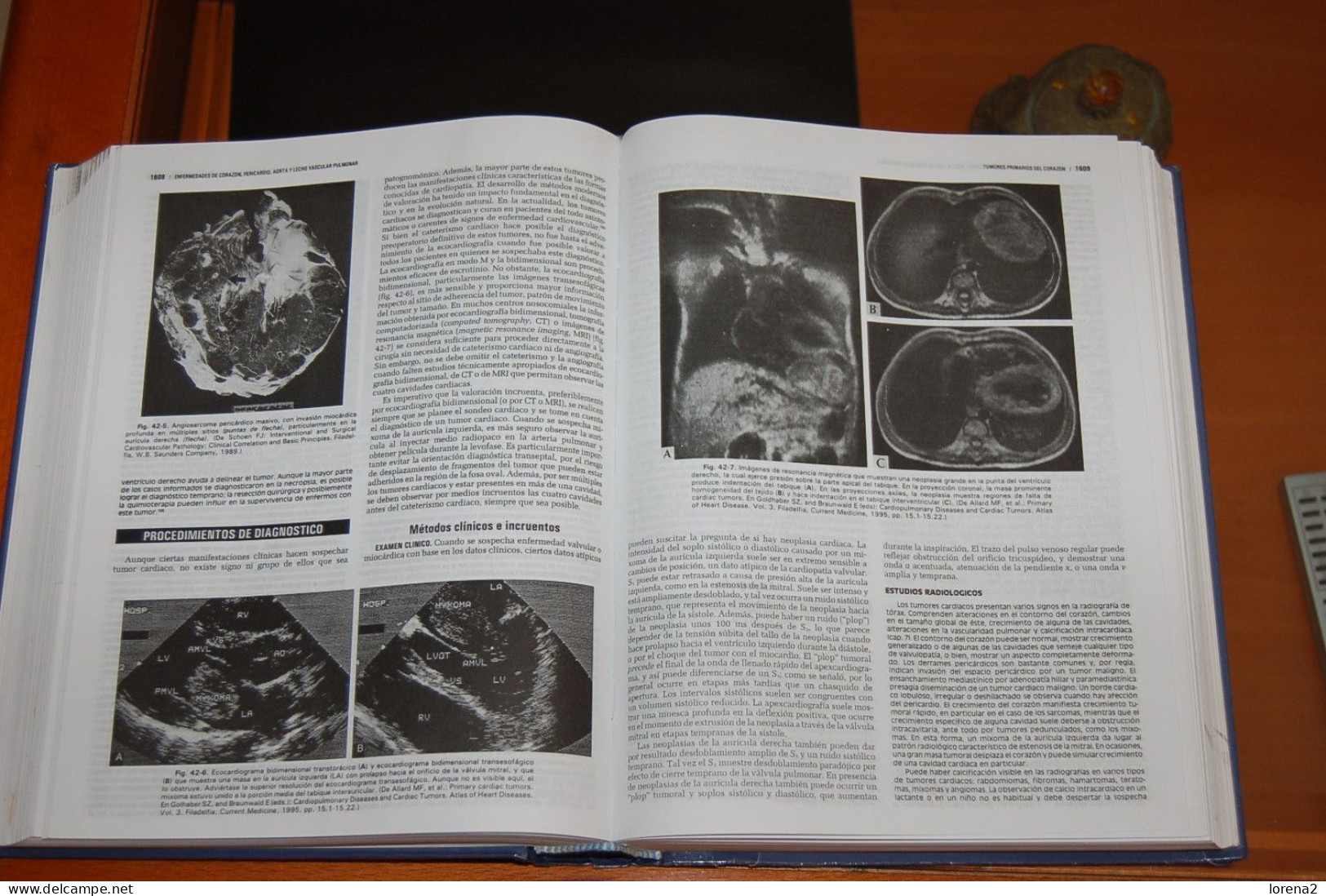 Libro Tratado De Cardiología. 27-479 - Other & Unclassified