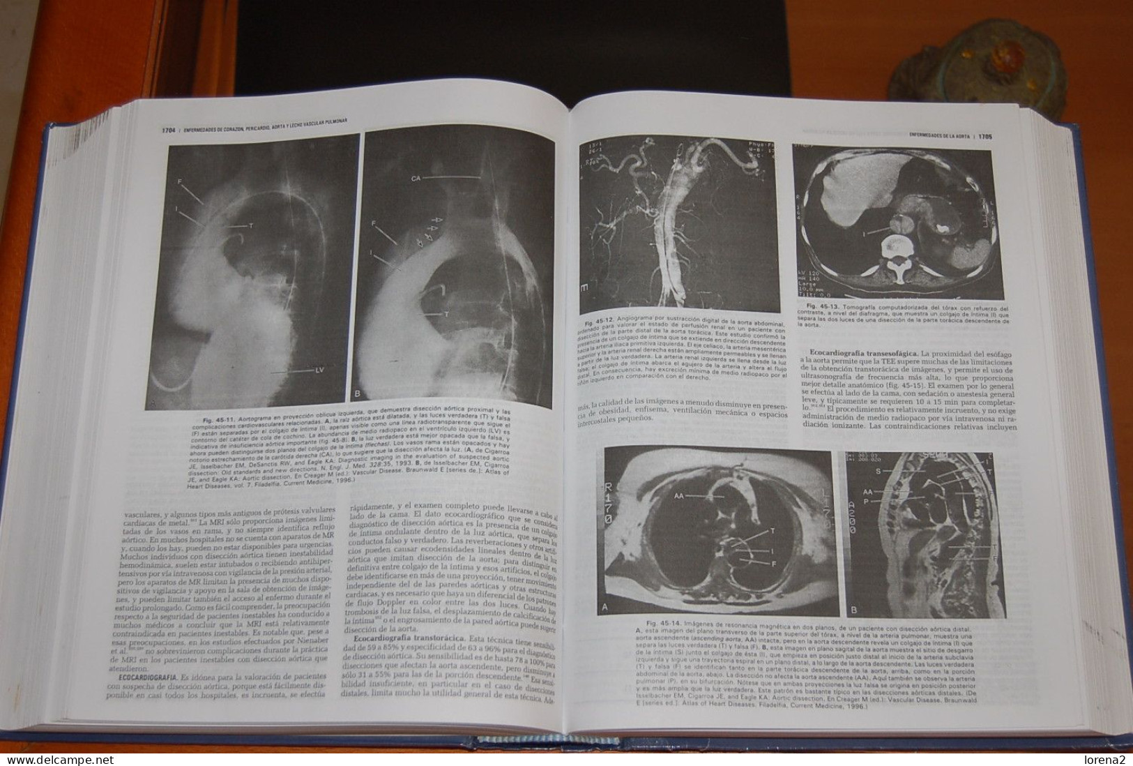 Libro Tratado De Cardiología. 27-479 - Otros & Sin Clasificación