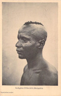 Congo Belge - Indigène N'Gombé ( Bangala) - Scarification  - Carte Postale Ancienne - Belgian Congo