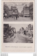 L13-62) CALAIS - LA RUE ROYALE  - AVANT ET APRES LA GUERRE  -  ( 2 SCANS ) - Calais