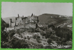 Vianden - Les Ruines Et Le Sanatorium - Vianden